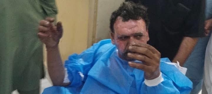 گزشتہ رات آسمان سے آنے والی پُراسرار آگ